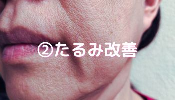 たるみ